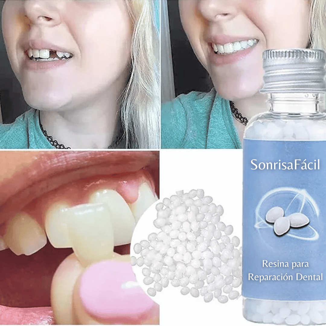 SonrisaFácil - Resina para Reparación Dental