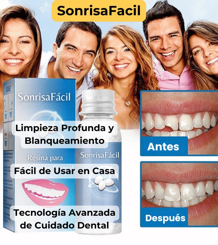 SonrisaFácil - Resina para Reparación Dental