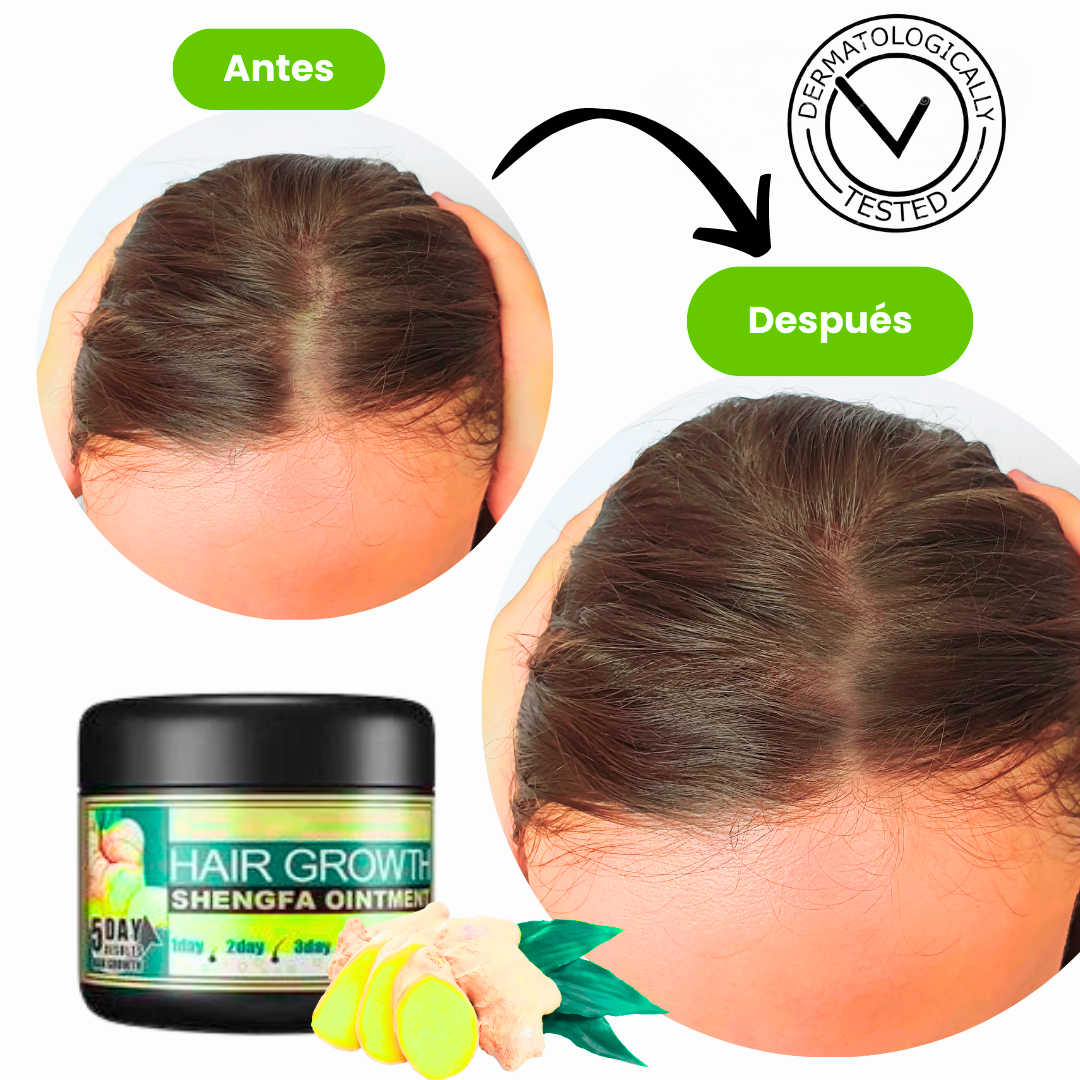 GROWHAIR Crema de Jengibre - Crece Cabello